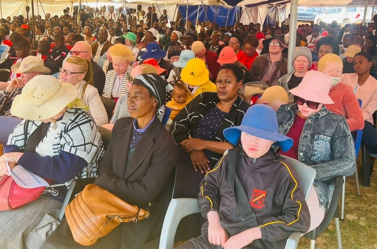 DEPUTY PRIME MINISTER THEMBA MASUKU: Persons with Albinism must be respected, protected.