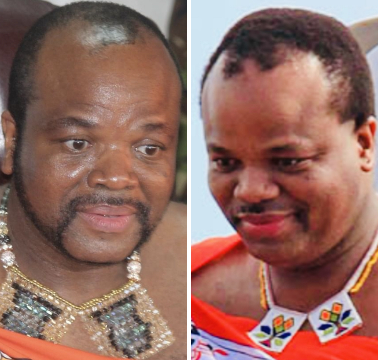 Concerns over Mswati’s swelling face,King’s Spokesperson says his health condition remains confidential.